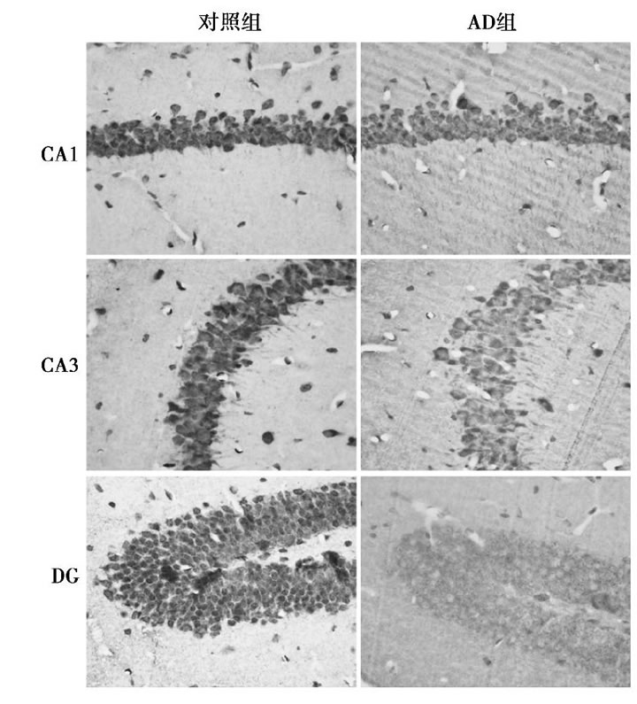 圖2 兩組小鼠各區Bcl2表達免疫組化結果